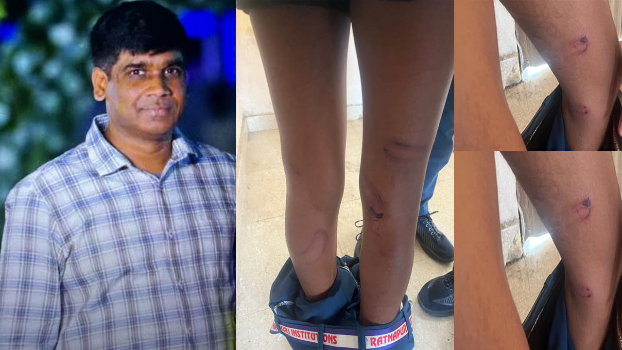 Telangana News: హోం వర్క్‌ చేయలేదనీ.. ఇంటర్‌ విద్యార్థులను వైర్లతో కొట్టిన ఉపాధ్యాయుడు!