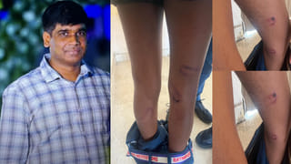 Telangana: ఎమ్మెల్యేలు దానం నాగేందర్, కడియం శ్రీహరికు ఊరట.. అనర్హత పిటిషన్లను కొట్టివేసిన స్పీకర్