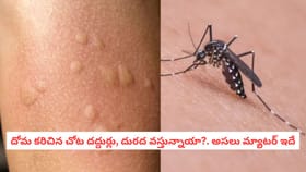 దోమ కరిచిన చోట దద్దుర్లు, దురద వస్తున్నాయా?. అసలు మ్యాటర్ ఇదే
