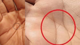 మీ అరచేతిలో 'X' గుర్తు ఉందా.. అయితే