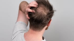 జీర్ణక్రియ సరిగ్గా లేకపోతే జుట్టు ఊడిపోతుందా?