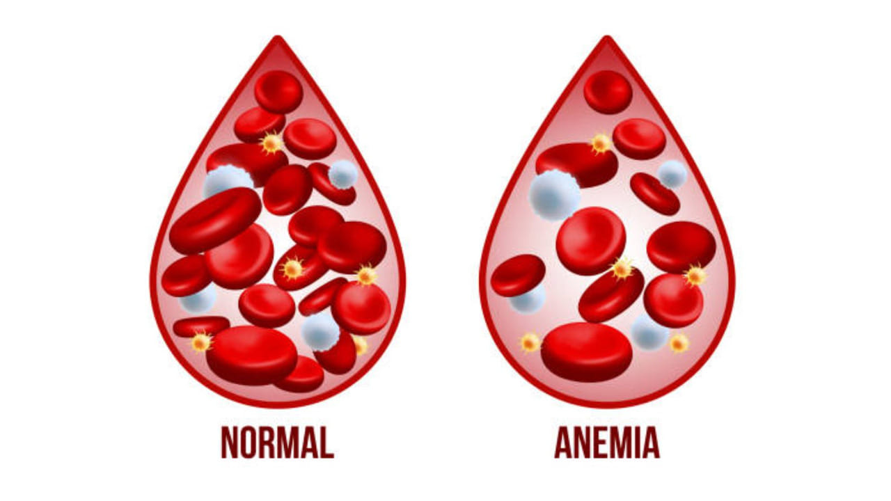 రక్తహీనత: కళ్ళు తిరగడం, నీరసం, ముఖం పాలిపోవడం ఐరన్ లోపం లక్షణాలు. మునగాకు ఐరన్ లోపానికి దివ్యౌషధం. వారానికి రెండు, మూడు సార్లు మునగాకు పప్పు లేదా కూర వండుకొని తినండి. ఖర్జూరాలు, బీట్‌రూట్, బెల్లం, రాజ్మా, పాలకూర వంటివి శాకాహారులకు ఐరన్ అందిస్తాయి. నాన్-వెజ్ తినేవారు మటన్ లివర్ తీసుకోవచ్చు. ఐరన్ శరీరానికి శోషించడానికి విటమిన్ సి అవసరం. ఆకుకూరలు లేదా ఐరన్ ఉన్న ఆహారం తిన్నప్పుడు నిమ్మరసం పిండండి లేదా భోజనం తర్వాత ఒక ఉసిరికాయ తినండి. ఐరన్ శోషణను అడ్డుకునే టానిన్స్ టీ, కాఫీలలో ఉంటాయి కాబట్టి, ఆహారానికి, టీ/కాఫీలకు కనీసం గంట వ్యవధి ఇవ్వాలి.