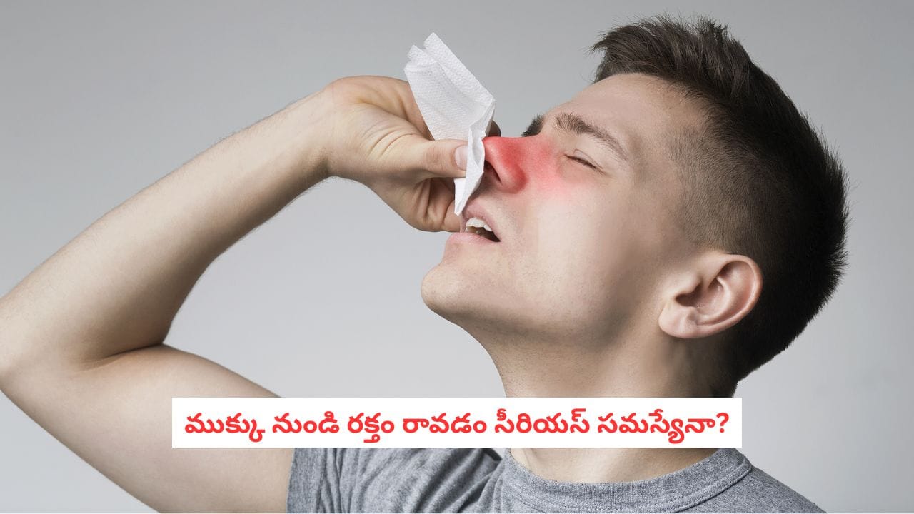Nose Bleed Tips:వేసవిలో ముక్కు నుండి రక్తం కారుతోందా? భయపడకండి.. అసలు కారణం ఇదీ!