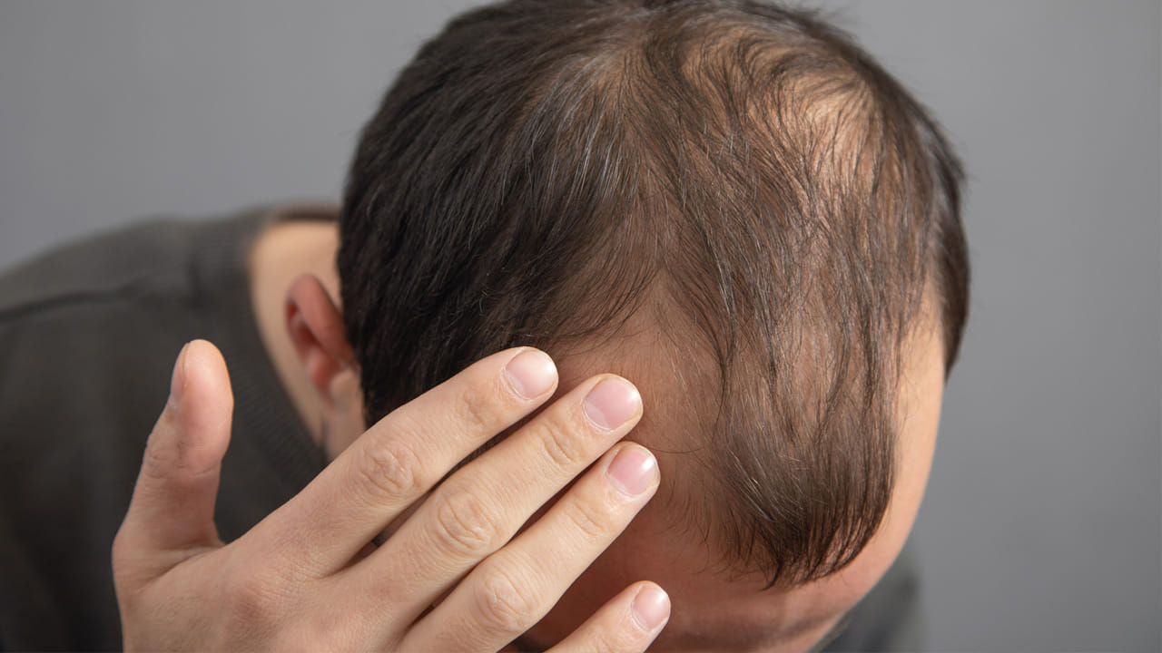 డా. ఠాకూర్ ఒక ఆసక్తికరమైన పోలికను ప్రస్తావించారు: మానసిక స్థిమితం లేని వ్యక్తులలో బట్టతల గానీ, జుట్టు రాలడం గానీ కనిపించదు. వారికి, ఆధునిక మనుషులకు మధ్య ఉన్న మూడు ప్రధాన తేడాలను ఆయన వివరించారు. పోషకాహారం పరంగా ఈ తేడా లేదని ఆయన స్పష్టం చేశారు.
