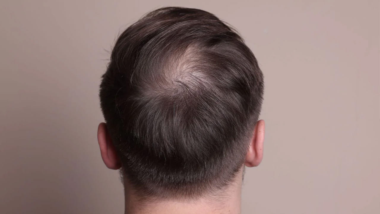 రెండవ తేడా సూర్యరశ్మికి బహిర్గతం. మానసిక స్థిమితం లేని వ్యక్తులు ఎక్కువగా ఎండలో ఉంటారు. అయితే, ఆధునిక జీవనశైలిలో చాలా మందికి సూర్యరశ్మికి తగినంత బహిర్గతం ఉండదు. మనిషి తలపైన జుట్టు ఉండటానికి కారణం సూర్యరశ్మి తలకు తగలడమేనని డా. ఠాకూర్ వివరించారు. సూర్యరశ్మి తగలకుండా ఉంటే జుట్టు రాలుతుందని, కాబట్టి సూర్యరశ్మికి తగినంతగా బహిర్గతం కావడం జుట్టు ఆరోగ్యానికి చాలా అవసరమని ఆయన స్పష్టం చేశారు.
