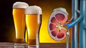 బీర్ తాగితే కిడ్నీలో రాళ్లు కరుగుతాయా.. డాక్టర్లు చెప్పే విషయాలు
