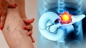 మీ కాళ్లలో ఈ 4 మార్పులు కనిపిస్తున్నాయా? అయితే డేంజర్