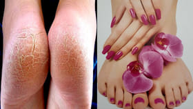 ఒక్క రాత్రిలోనే పగిలిన మడమలు మాయం..ఇంట్లోనే ఖర్చు లేని వైద్యం..?