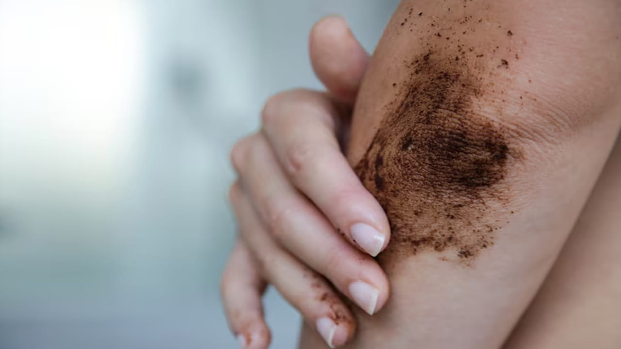 బేకింగ్ సోడా, పాలు: ఒక స్పూన్ బేకింగ్ సోడాకు తగినన్ని పాలు కలిపి పేస్ట్‌లా చేయాలి. దీనిని రాసి ఆరిన తర్వాత చల్లని నీటితో కడిగేయాలి. ఇది చర్మంపై ఉన్న మృతకణాలను తొలగించడంలో అద్భుతంగా పనిచేస్తుంది.