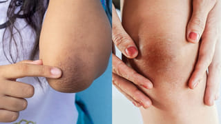 మహిళలు రాత్రిపూట పెరుగు తింటే ఏమవుతుందో తెలుసా..? ఇవి తప్పక తెలుసుకోండి..