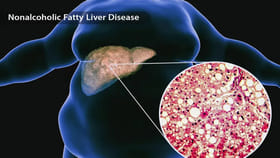 పిల్లల్లోనూ ఫ్యాటీ లివర్‌ సమస్యలు.. అసలు ఇది ఎందుకు వస్తుందంటే?