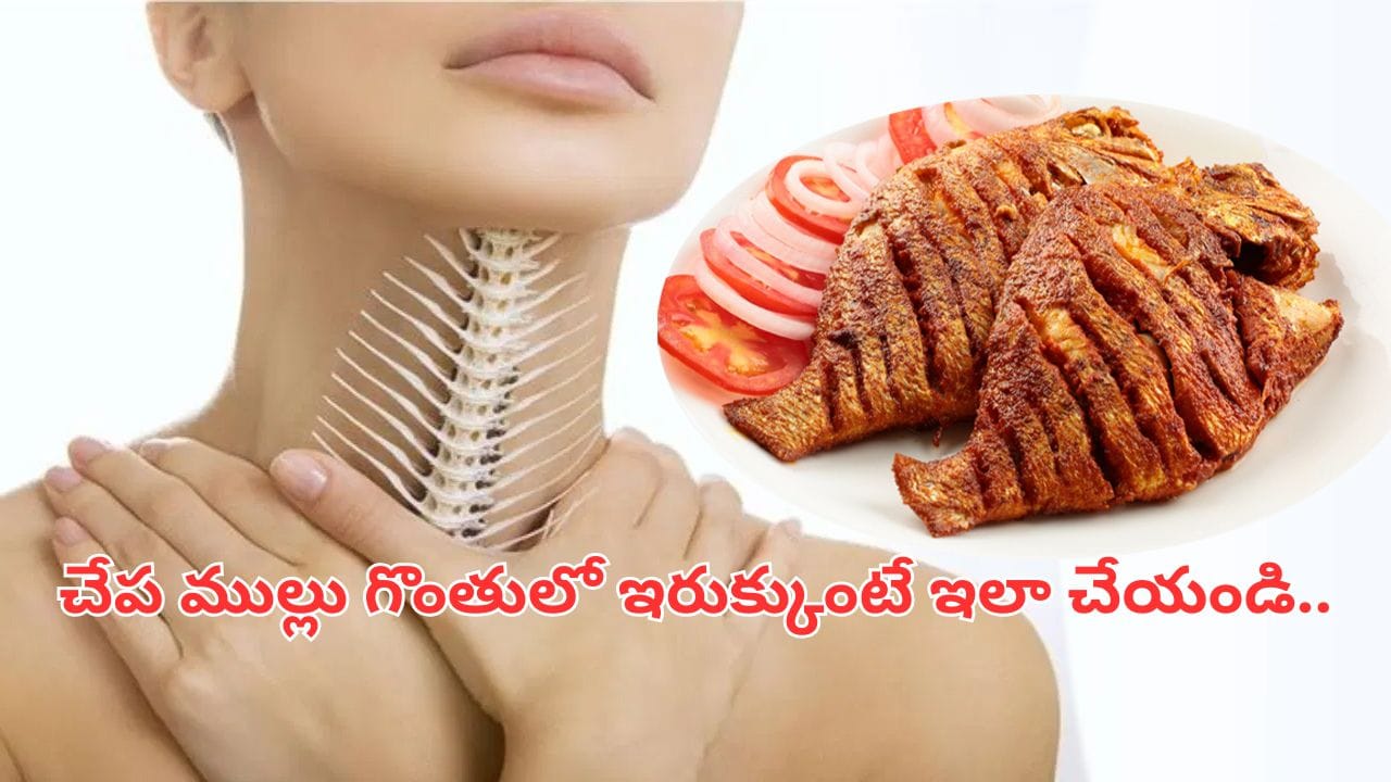 చేప ముల్లు గొంతులో ఇరుక్కుందా ? వెంటనే ఇలా చేయండి.. ఒక్క సెక‌న్‌లోనే రిలీఫ్