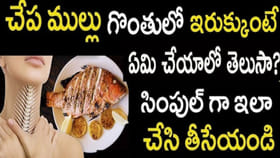 గొంతులో చేప ముల్లు ఇరుక్కుంటే ఏమి చేయాలంటే..