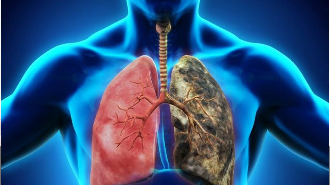 Lung Health Tests at Home: 2 మెట్లు ఎక్కినా ఆయాసంగా ఉంటుందా? అయితే మీ ఊపిరితిత్తులపై ఓ కన్నేయాల్సిందే..