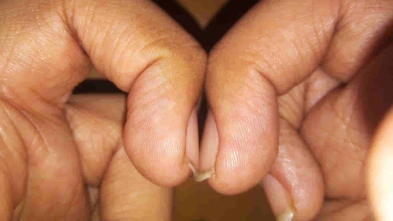 గోళ్లలో దాగిన క్యాన్సర్ రహస్యం.. ఇలా ఉంటే జాగ్రత్త..