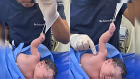 పుట్టిన వెంటనే డాక్టర్‌నే ఆపేసిన పసిపాప! ఆ చిన్నారి పట్టు చూస్తే