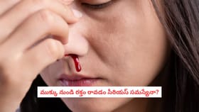ముక్కు నుండి రక్తం రావడం సీరియస్ సమస్యేనా?