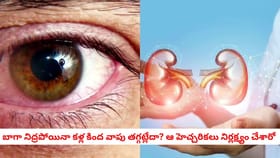 బాగా నిద్రపోయినా కళ్ల కింద వాపు తగ్గట్లేదా? ఆ హెచ్చరికలు నిర్లక్ష