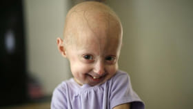 చిన్నారులను భయపెడుతున్న అరుదైన జన్యు వ్యాధులు.. మేనరికమే కారణమా?