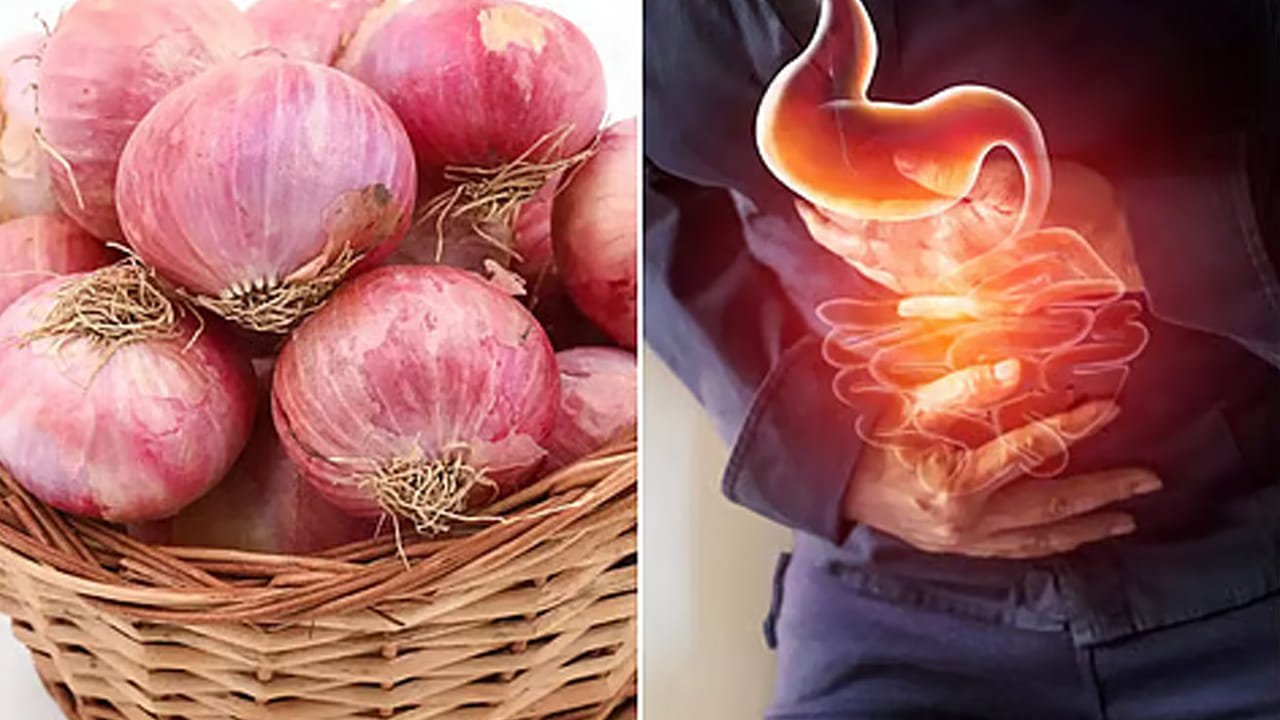 గుండెల్లో మంట (Heartburn): పచ్చి ఉల్లిపాయలు తిన్నప్పుడు కడుపులో యాసిడ్ స్థాయిలు పెరిగే అవకాశం ఉంటుంది. దీనివల్ల ఛాతీలో మంట లేదా గొంతులో మంటగా అనిపించవచ్చు. ముఖ్యంగా రాత్రిపూట పచ్చి ఉల్లిపాయలు తినడం మానుకోవాలి.
