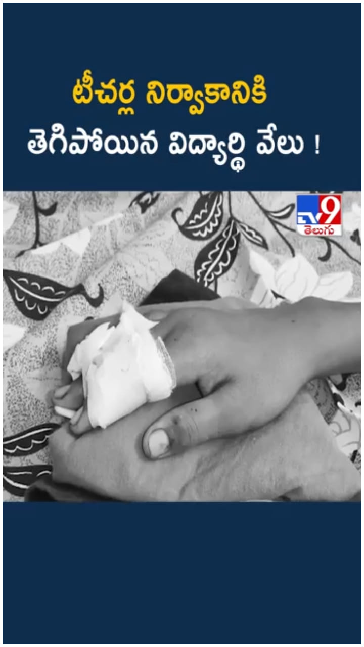 అయ్యో.. టీచర్ల నిర్వాకానికి తెగిపోయిన విద్యార్థి వేలు..!