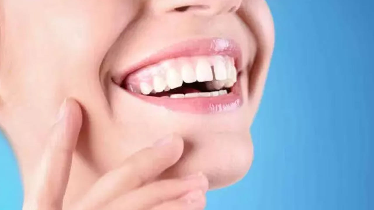 కానీ చాలా మంది అమ్మాయిలకు కూడా పళ్ల మధ్య సందు ఉంటుంది. అయితే ఇలా పళ్ల మధ్య సందు ఉండటం చాలా అదృష్టం అంటున్నారు నిపుణులు. దీని వలన లక్కు కలిసి వస్తుందంట.  ముఖ్యంగా ఇలా పళ్ల మధ్య సందు ఉన్నవారు చాలా అదృష్టం వంతులు , తెలివైన వారు అని చెబుతున్నారు పండితులు.