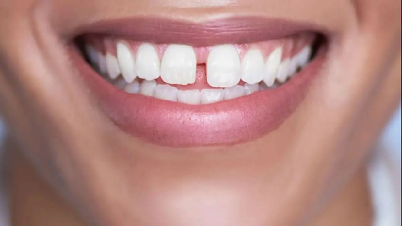 అందుకే పళ్ల మధ్య గ్యాప్ ఉన్న అమ్మాయిని వివాహం చేసుకోవడం చాలా మంచిది అని చెబుతున్నారు నిపుణులు.నోట్ : ఈ వార్తలలో ఇవ్వబడిన సమాచారం మత విశ్వాసాలపై ఆధారపడి ఉంది. పాఠకుల ఆసక్తి మేరకు.. పలువురు పండితుల సూచనలు, వారి తెలిపిన అంశాల ఆధారంగా అందించినవి మాత్రమే.. వీటిలో ఎలాంటి శాస్త్రీయ ఆధారాలు లేవని పాఠకులు గమనించాలి. టీవీ9 తెలుగు దీనిని ధృవీకరించలేదు