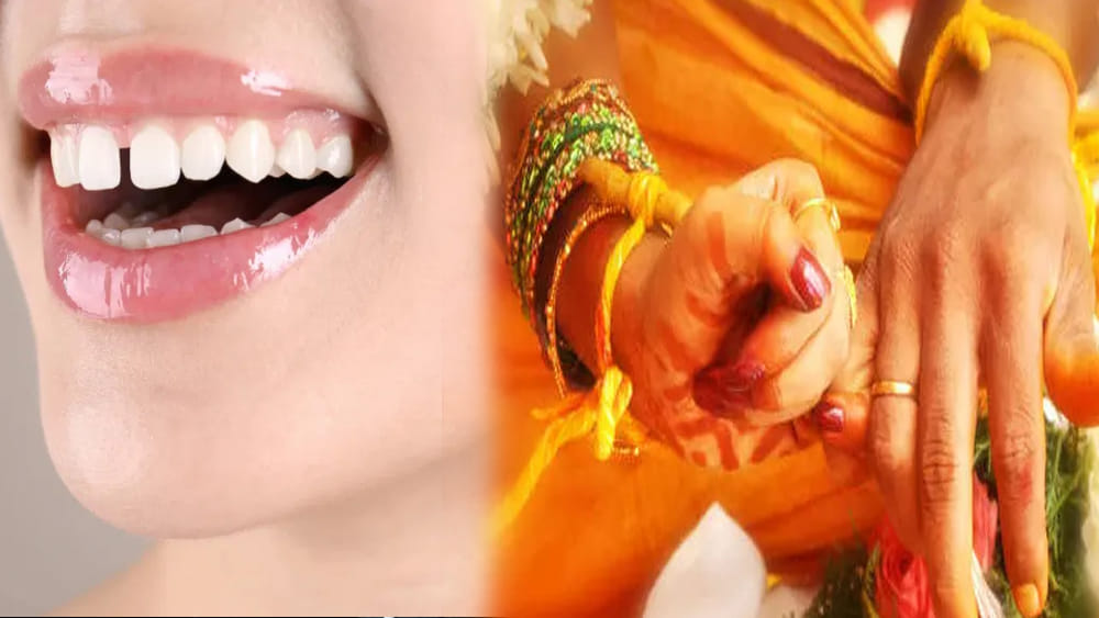 పళ్ల మధ్య సందు ఉన్న అమ్మాయిని వివాహం చేసుకుంటే అదృష్టం కలిసి వస్తుందా?