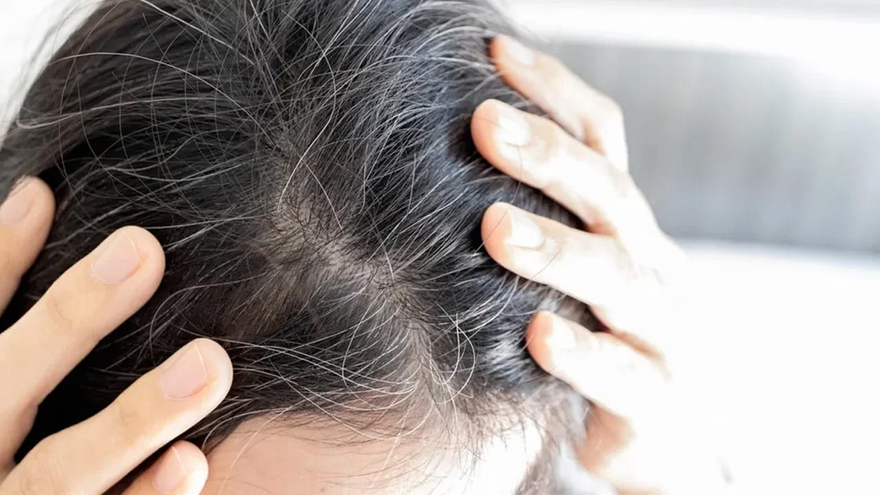 ఇక ఆయుర్వేద శాస్త్రంలో భృంగరాజ్ అని చెప్పుకునే గుంటగలగర ఆకు తెల్ల జుట్టుకు పూర్తిగా చెక్ పెట్టగలదు. దీనిలో ఉండేవి తెల్ల జుట్టుపై పోరాడి మెలనిన్ ఉత్పత్తిని పెంచుతాయి. అయితే, పసుపు రంగు పూలు కేశ సంరక్షణలో హెల్ప్ చేస్తాయని పరిశోధనలు చెబుతున్నాయి.