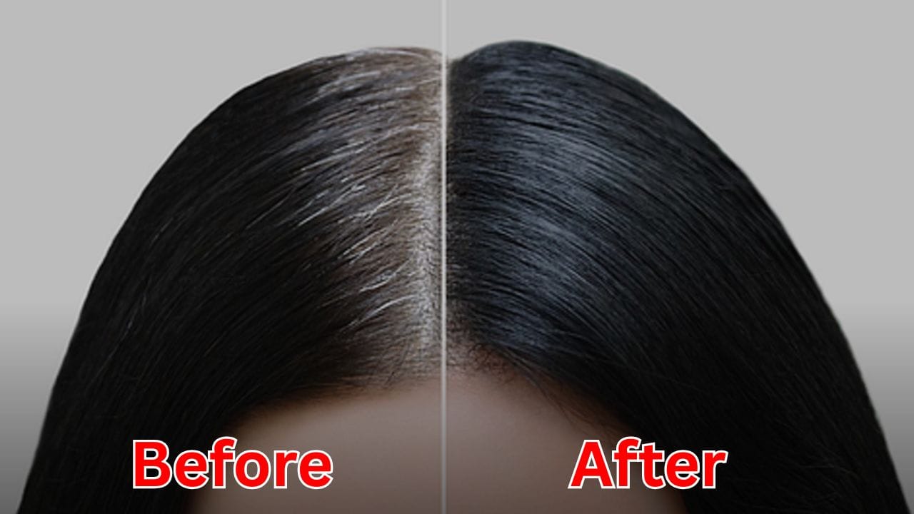 Grey Hair: తెల్ల జుట్టు వెక్కిరిస్తుందా..? కిచెన్లో దొరికే వీటితో నిమిషాల్లో నల్లగా మార్చుకోండి!