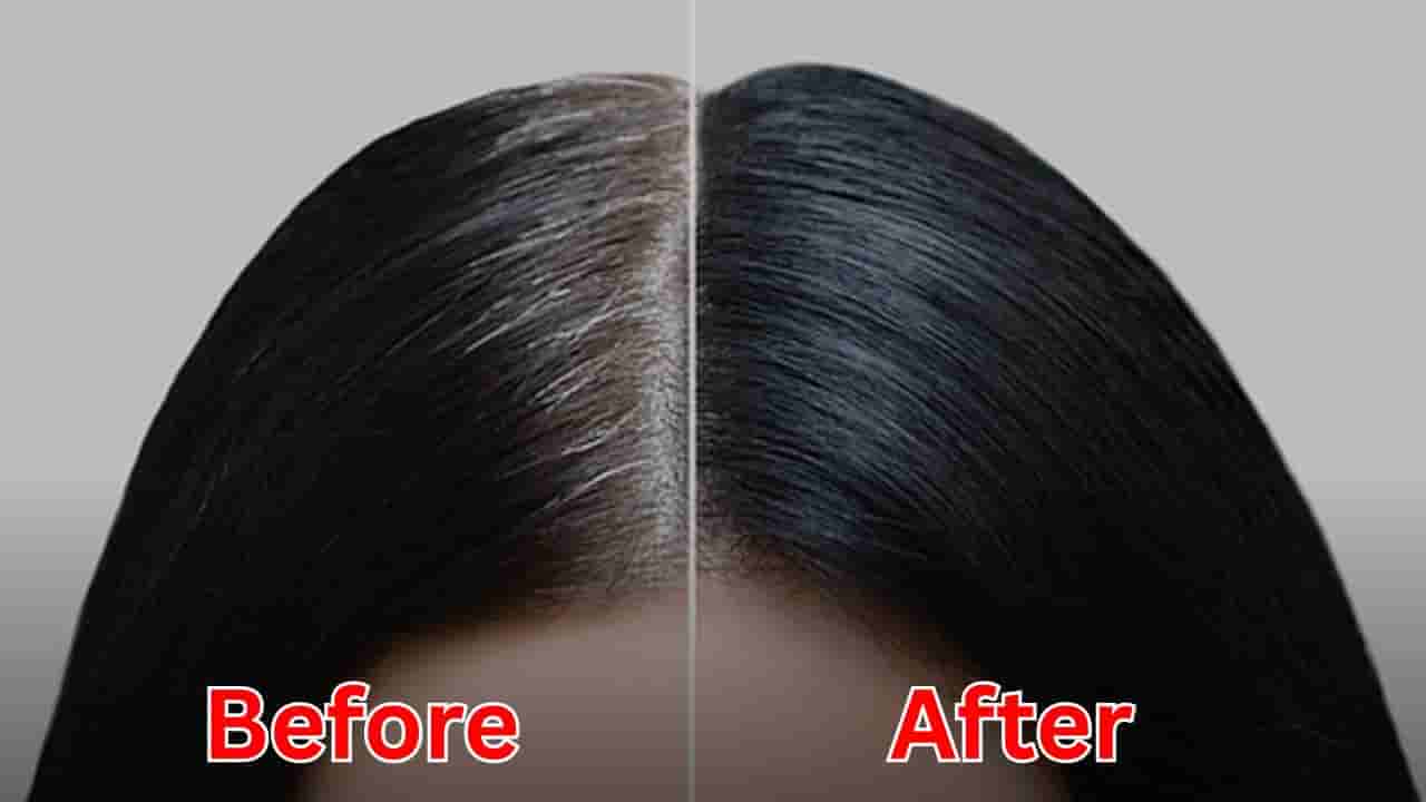 Grey Hair: తెల్ల జుట్టు వెక్కిరిస్తుందా..? కిచెన్లో దొరికే వీటితో నిమిషాల్లో నల్లగా మార్చుకోండి!