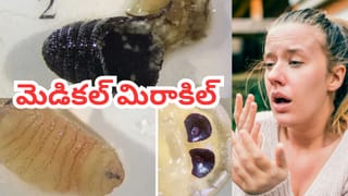 Viral Video: కడుపు ఉబ్బిపోయి కనిపించిన కొండచిలువ.. పట్టుకుని పొట్ట ఎక్స్‌రే తీయగా