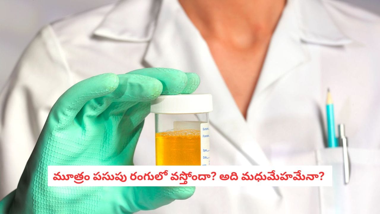 Diabetes Alert: మూత్రం పసుపు రంగులో వస్తోందా? అది మధుమేహానికి సంకేతమా? అసలు నిజం ఇదీ!