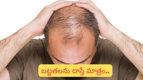 బట్టతల ఉన్నవాళ్లకు అదృష్టం ఎక్కువా? షాకింగ్ జ్యోతిష్య రహస్యం!