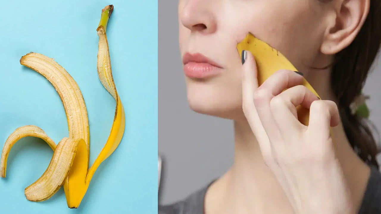 వేసవి చర్మ సమస్యలకు చెక్ (Soothes Skin Irritation): ముఖ్యంగా వేసవి కాలంలో ఎండ తీవ్రత వల్ల చర్మంపై మంట, దురద లేదా ఎరుపుదనం వంటి సమస్యలు ఎదురవుతాయి. అటువంటప్పుడు అరటి తొక్కను ముఖంపై రుద్దడం వల్ల చర్మం చల్లబడి, ఉపశమనం లభిస్తుంది.