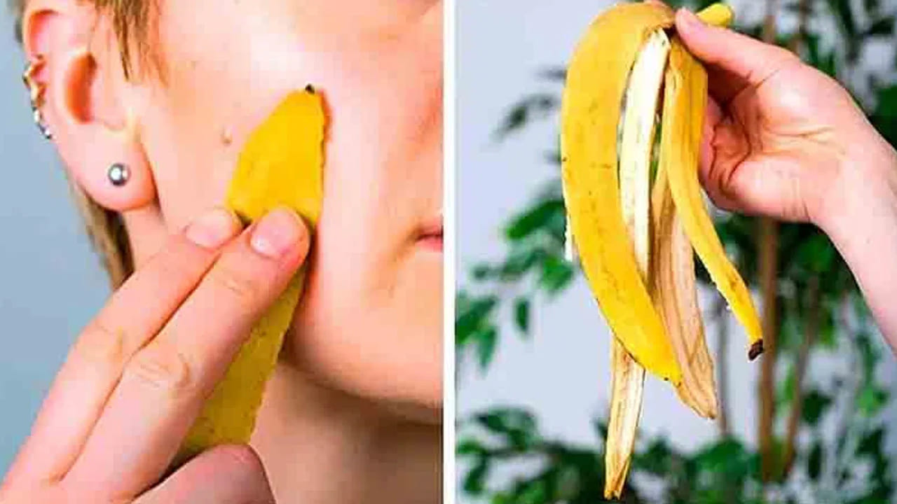 ముడతల నివారణ (Anti-Aging): వయసు పెరిగే కొద్దీ ముఖంపై ముడతలు రావడం సహజం. అరటిపండు తొక్కతో ముఖాన్ని మసాజ్ చేయడం వల్ల చర్మంపై ఉన్న ముడతలు, సన్నని గీతలు క్రమంగా తగ్గుతాయి. ఇది చర్మాన్ని బిగుతుగా మార్చి యవ్వనంగా కనిపించేలా చేస్తుంది.