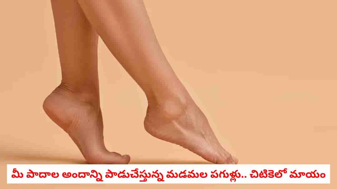Cracked Heels: కాళ్ల పగుళ్లు వేధిస్తున్నాయా? ఈ 5 సింపుల్ టిప్స్ పాటిస్తే మీ పాదాలు పట్టులా మెరిసిపోవడం ఖాయం!