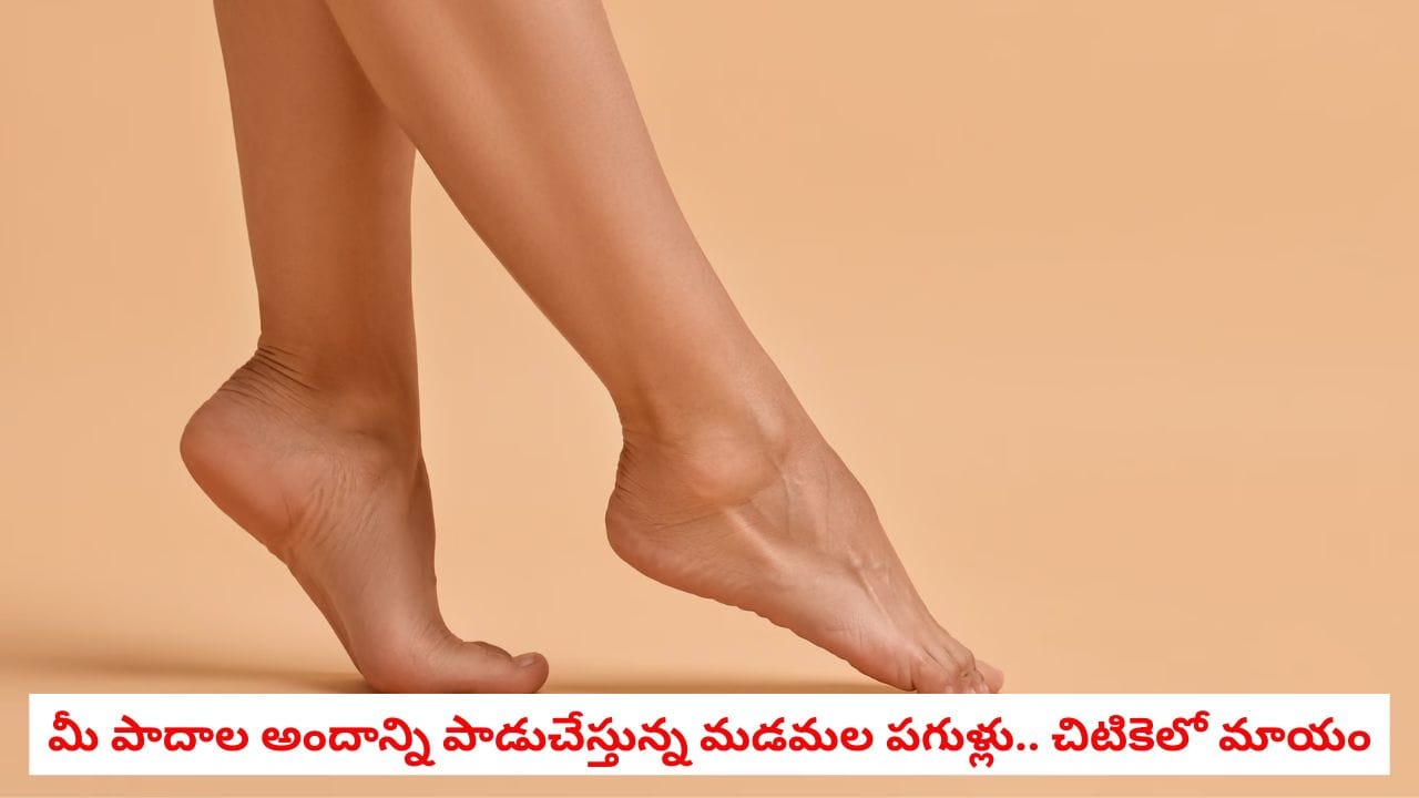 Cracked Heels: కాళ్ల పగుళ్లు వేధిస్తున్నాయా? ఈ 5 సింపుల్ టిప్స్ పాటిస్తే మీ పాదాలు పట్టులా మెరిసిపోవడం ఖాయం!
