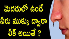 మెదడులో ఉండే నీరు ముక్కు ద్వారా లీక్ అయితే..?