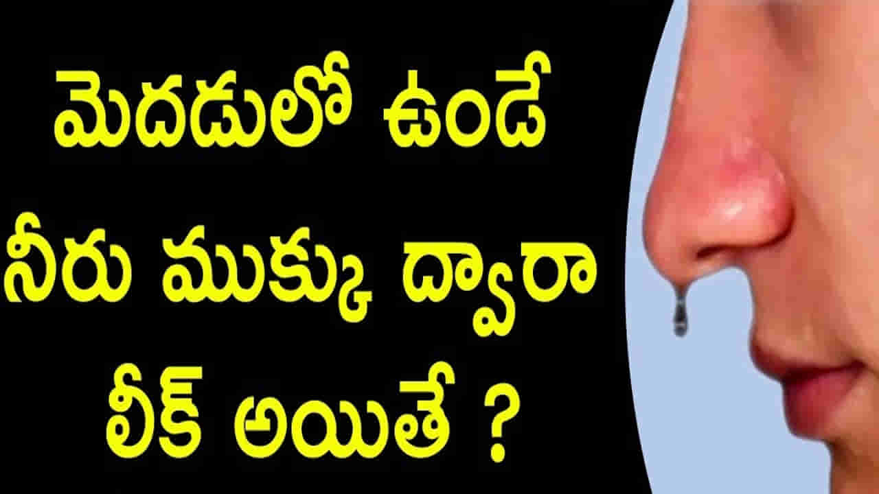 మెదడులో ఉండే నీరు ముక్కు ద్వారా లీక్ అయితే..?