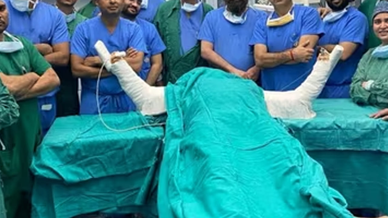 
ఈ శస్త్రచికిత్సలో ప్లాస్టిక్ సర్జన్లు, ఆర్థోపెడిక్ నిపుణులు, నెఫ్రాలజిస్టులు, అనస్థీషియా బృందం, ఐసీయూ వైద్యులు, మనోవైద్య నిపుణులు, ఫిజియోథెరపిస్టులు కలిసి పనిచేశారు. ఈ సమన్వయం కారణంగానే ఆపరేషన్ విజయవంతమైందని వైద్యులు తెలిపారు. 
