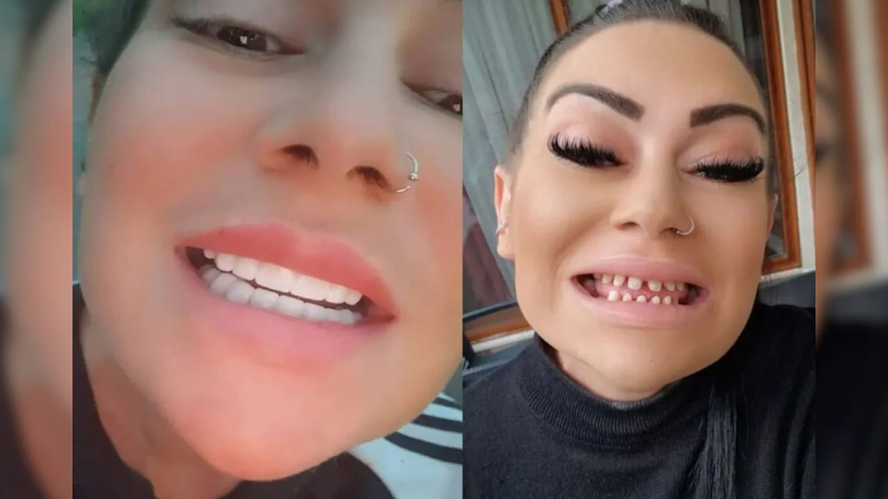 Dental Surgery Gone Wrong