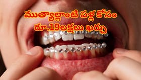 అందమైన చిరునవ్వు కోసం రూ.19 లక్షలతో సర్జరీ..ఆ తర్వాత జరిగింది ఇదే