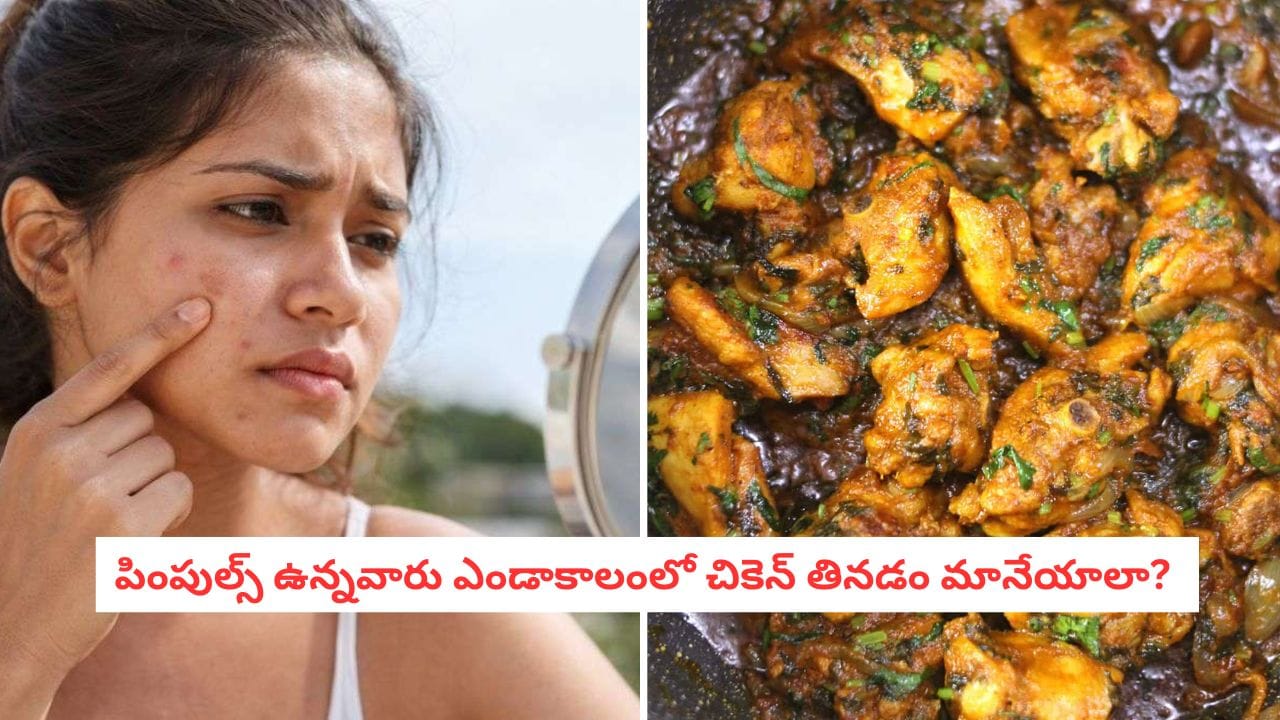 Chicken Facts: ఎండకాలంలో చికెన్ తింటే మొటిమలు వస్తాయా? అసలు నిజం తెలిస్తే షాక్ అవుతారు!