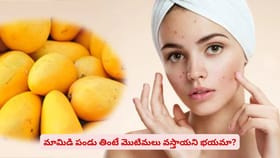 మామిడి పండు తింటే మొటిమలు వస్తాయని భయమా?
