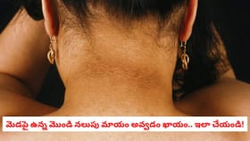 మెడపై ఉన్న మొండి నలుపు మాయం అవ్వడం ఖాయం.. ఇలా చేయండి!