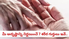 లక్షలాది మందిలో ఒక్కరికి మాత్రమే ఉండే ఈ గుర్తు మీకుందా?