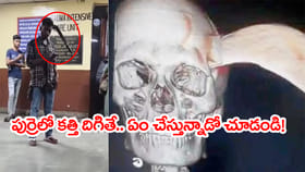తలలో దిగిన కొడవలితో ఆసుపత్రికి నడిచి వెళ్లిన యువకుడు.. వీడియో