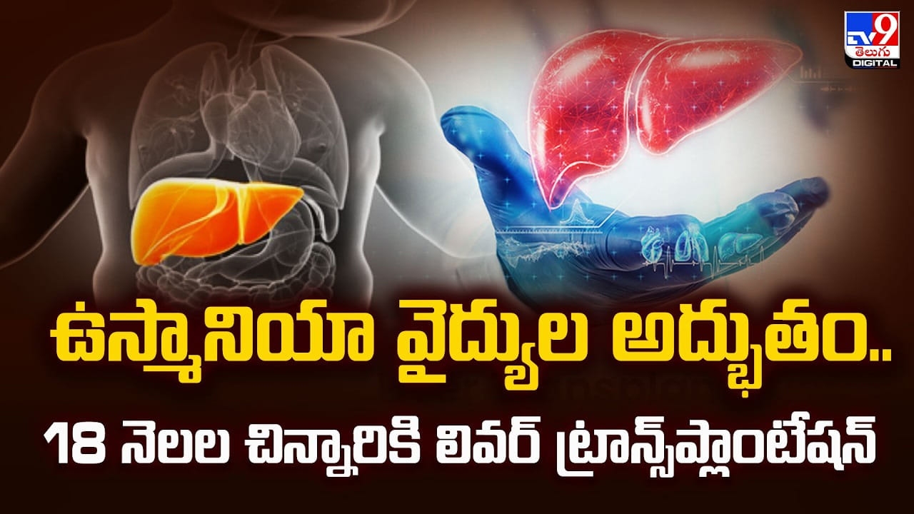 ఉస్మానియా వైద్యుల అద్భుతం..18 నెలల చిన్నారికి లివర్ ట్రాన్స్‌ప్లాంటేషన్