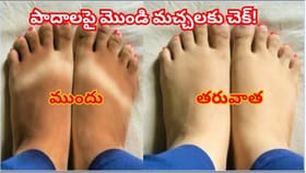 పాదాలపై చెప్పుల మొండి మచ్చలా? ఇంట్లో ఈ 3 పదార్థాలు ఉంటే చాలు! ఈజీ